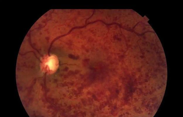 产生幻觉的原因和解决方法（探究人类幻觉现象的本质，从科学角度寻找有效治疗手段）-第1张图片-恋语空间